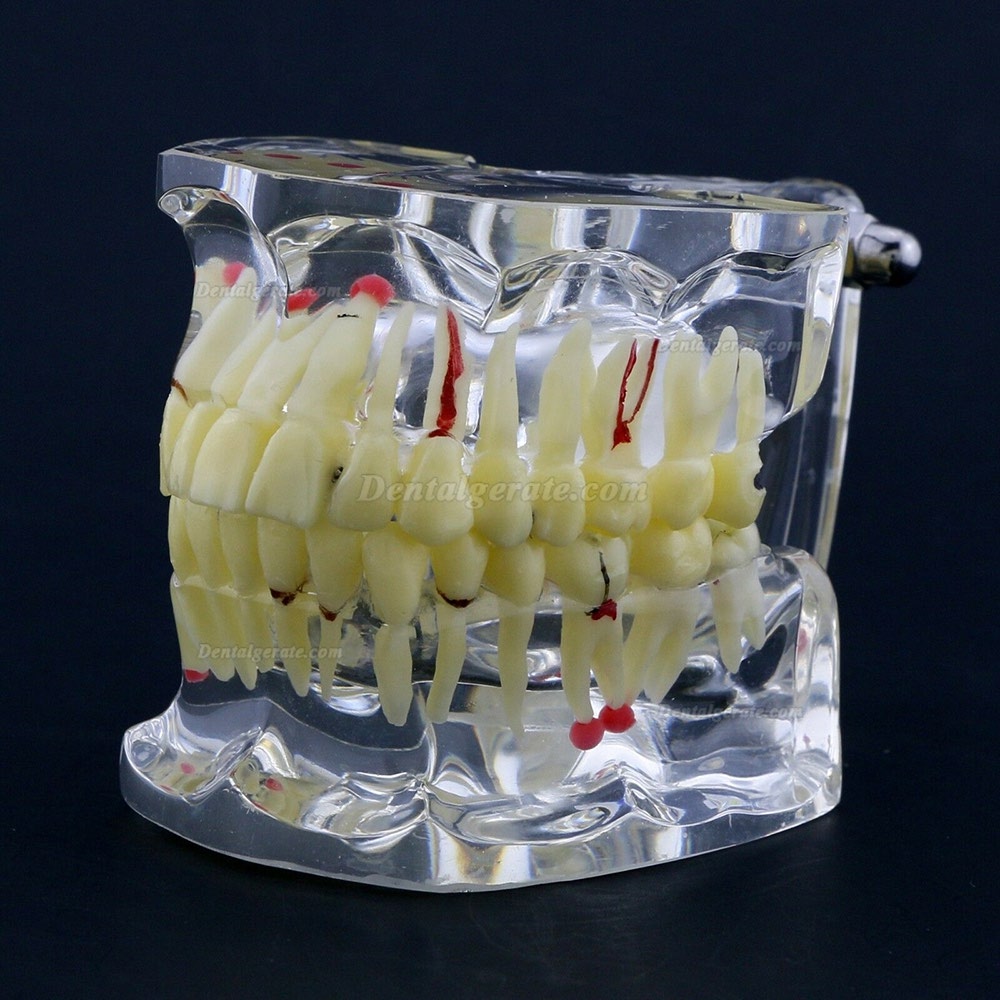 Neue Dental Teach-Studie Allgemeine Erwachsenenpathologie Typodont Z&auml;hne Modell # 4001